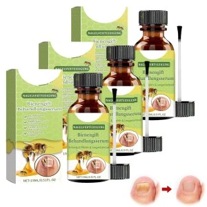 SIGMA FONGISTOP SOLUTION MYCOSE ONGLES 15ML
